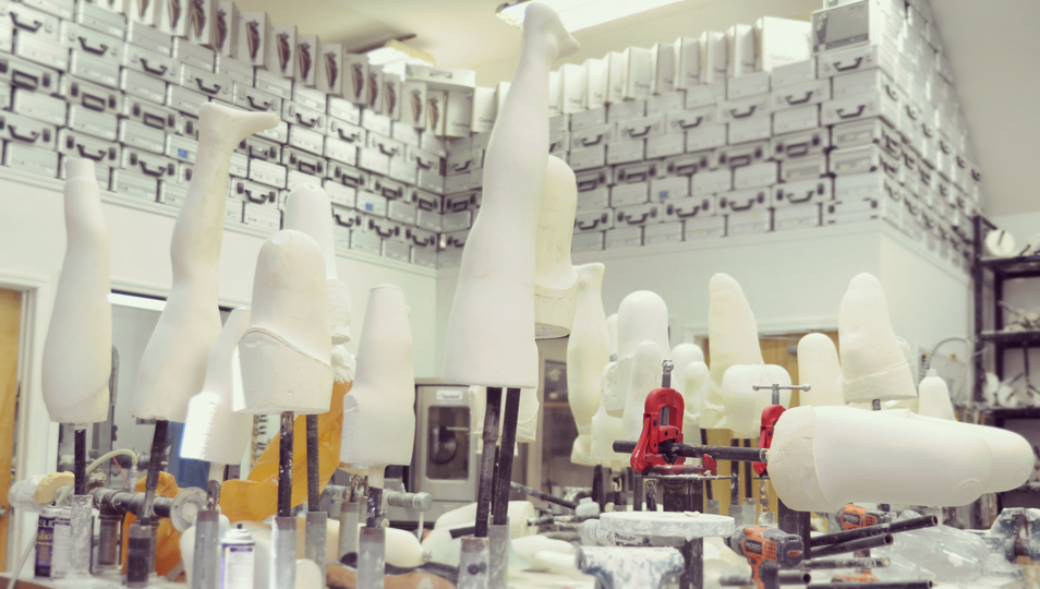After careful evaluation of the residual limb, positive molds are hand-sculpted.