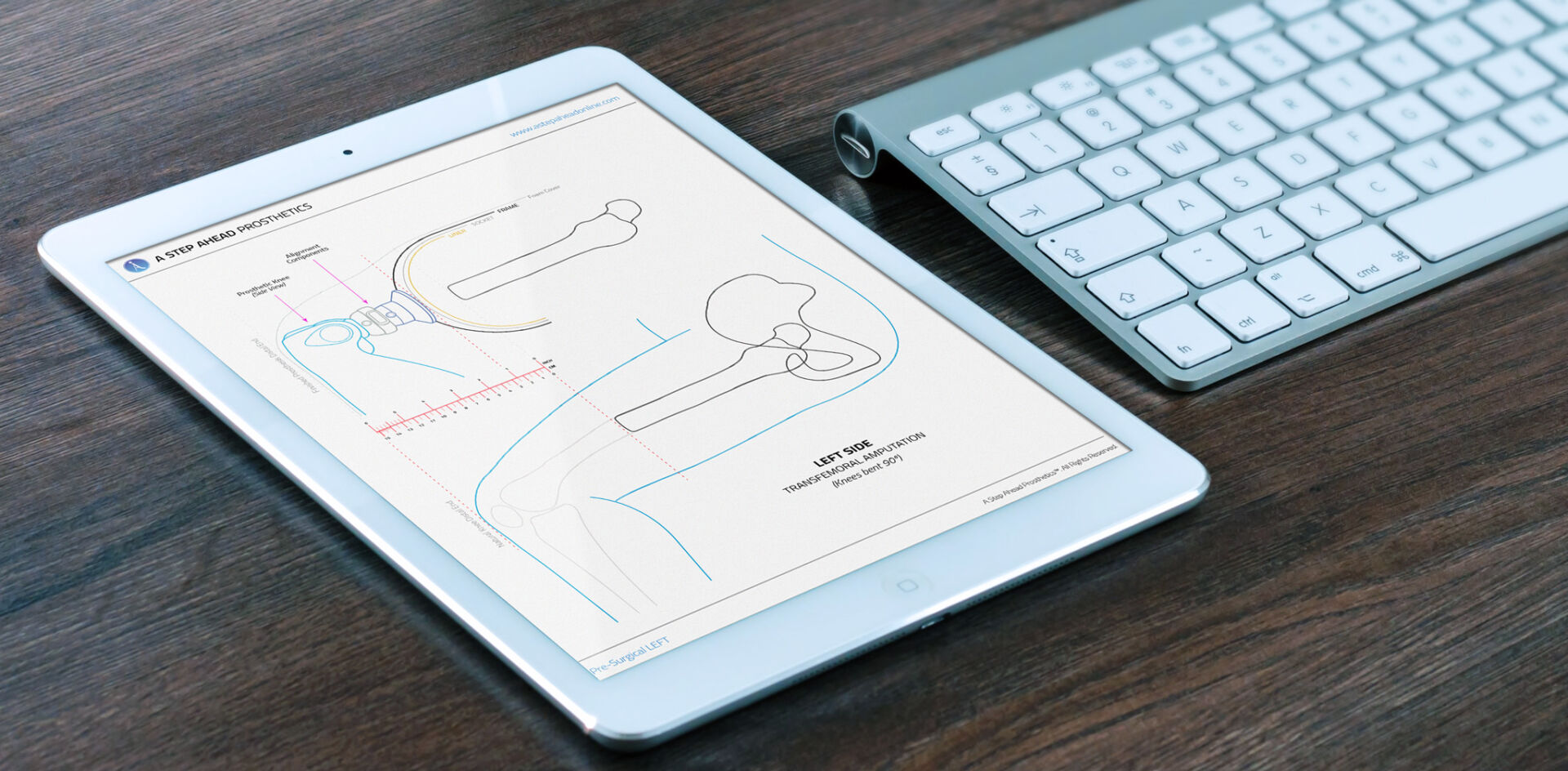 ipad-template-B - A Step Ahead Prosthetics