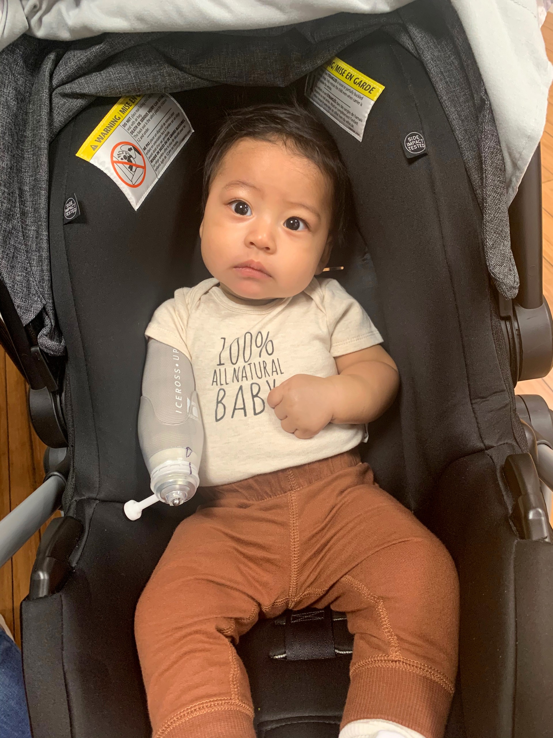 Photos A Step Ahead Prosthetics