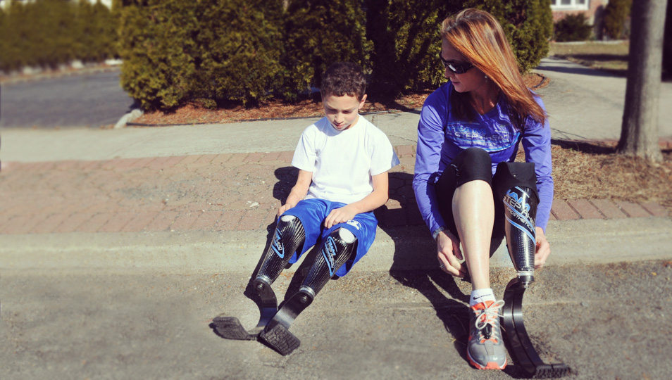 A Step Ahead Prosthetics