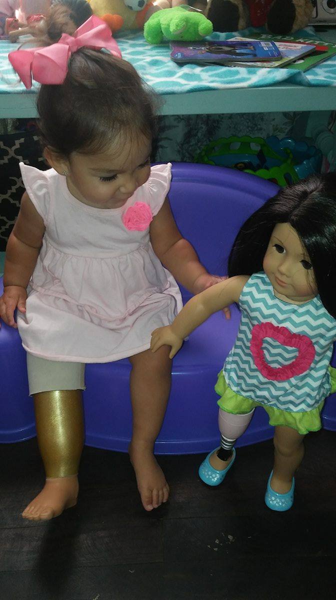 American Girl doll with a prosthetic leg