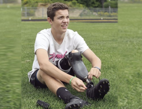 Rotationplasty amputee joins his HS football on the field again