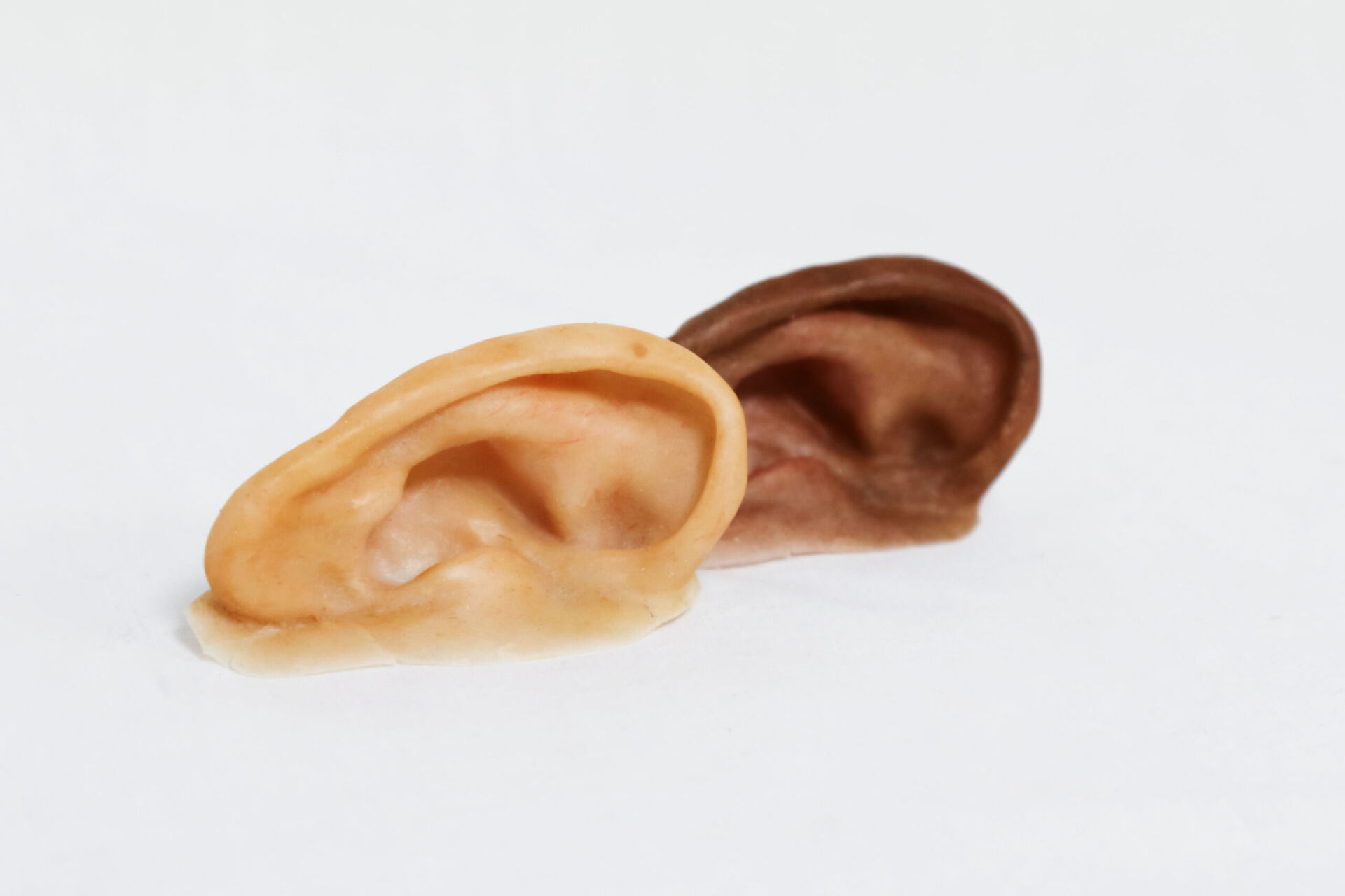 real looking ear prosthetics