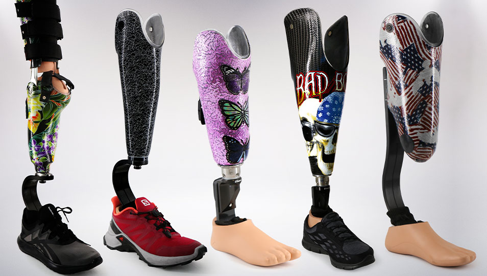 Below Knee (BK) Prosthetic legs for amputees.