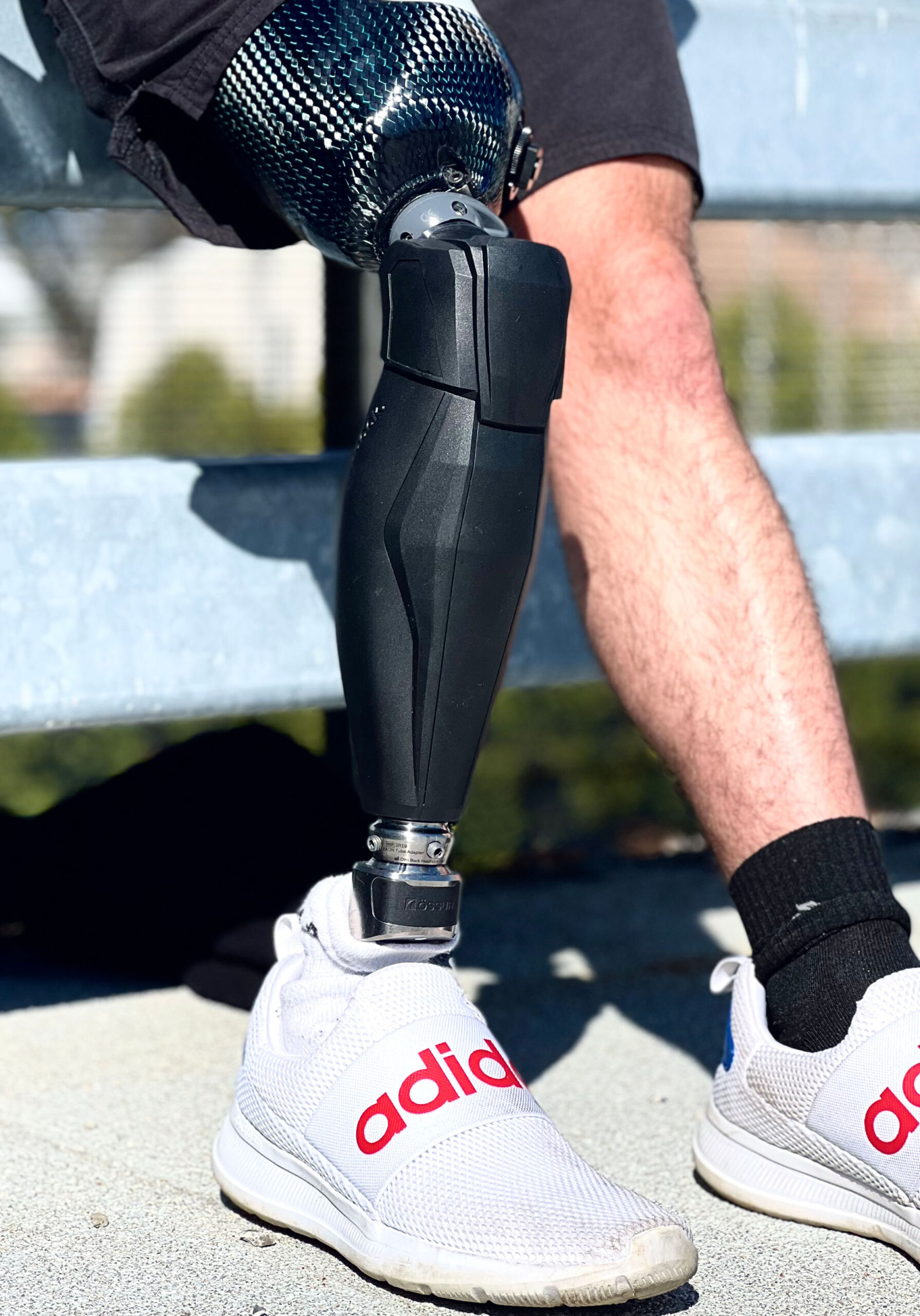 Above-knee prosthetics Leg. #prosthetic #prostheticleg #amputee #limbloss