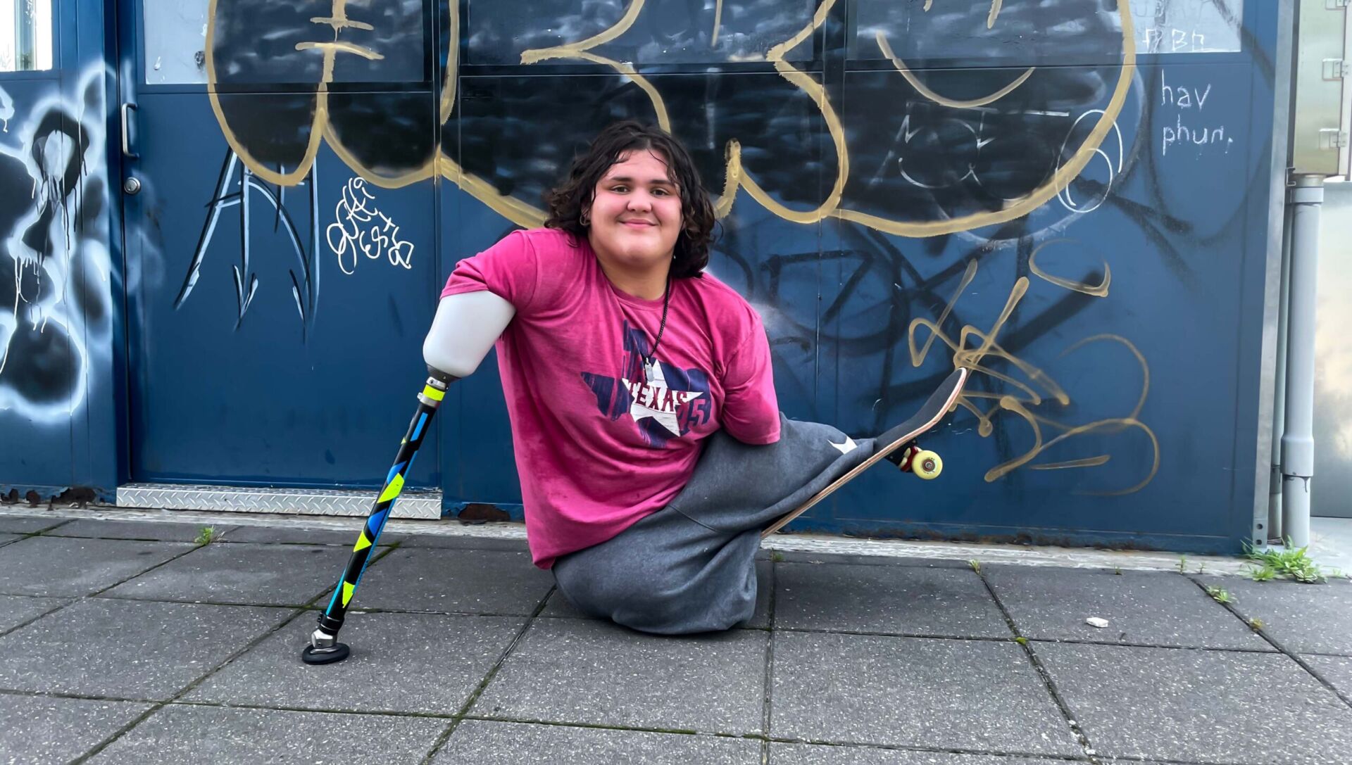 Quadruple Amputee using custom skateboarding Arm prosthetics. Prosthetic Technology