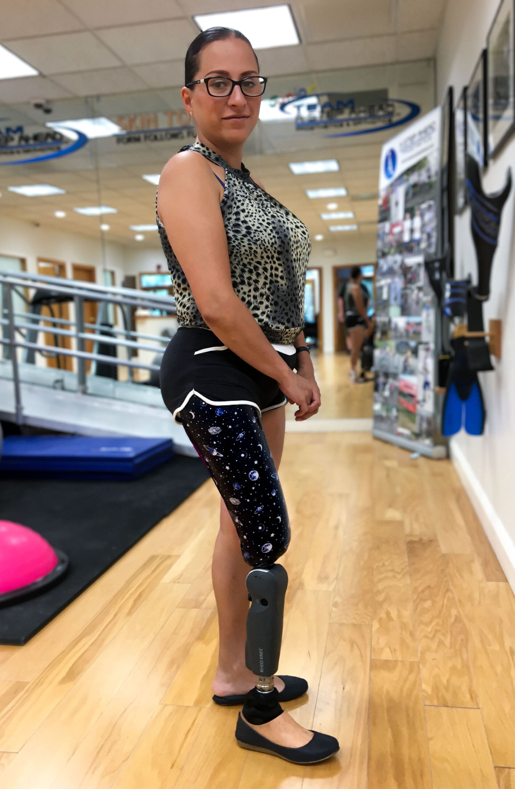 Above Knee Prosthetic Leg | AK prosthesis