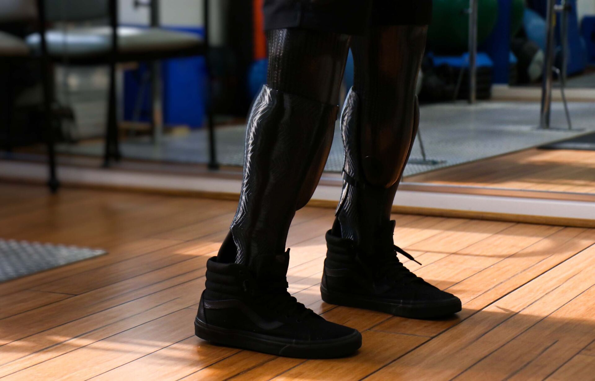 3d printed prosthesis covers for prosthetic legs
