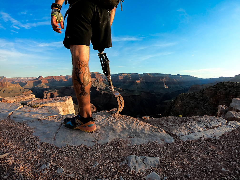 Above knee amputee putting his prosthesis to use!