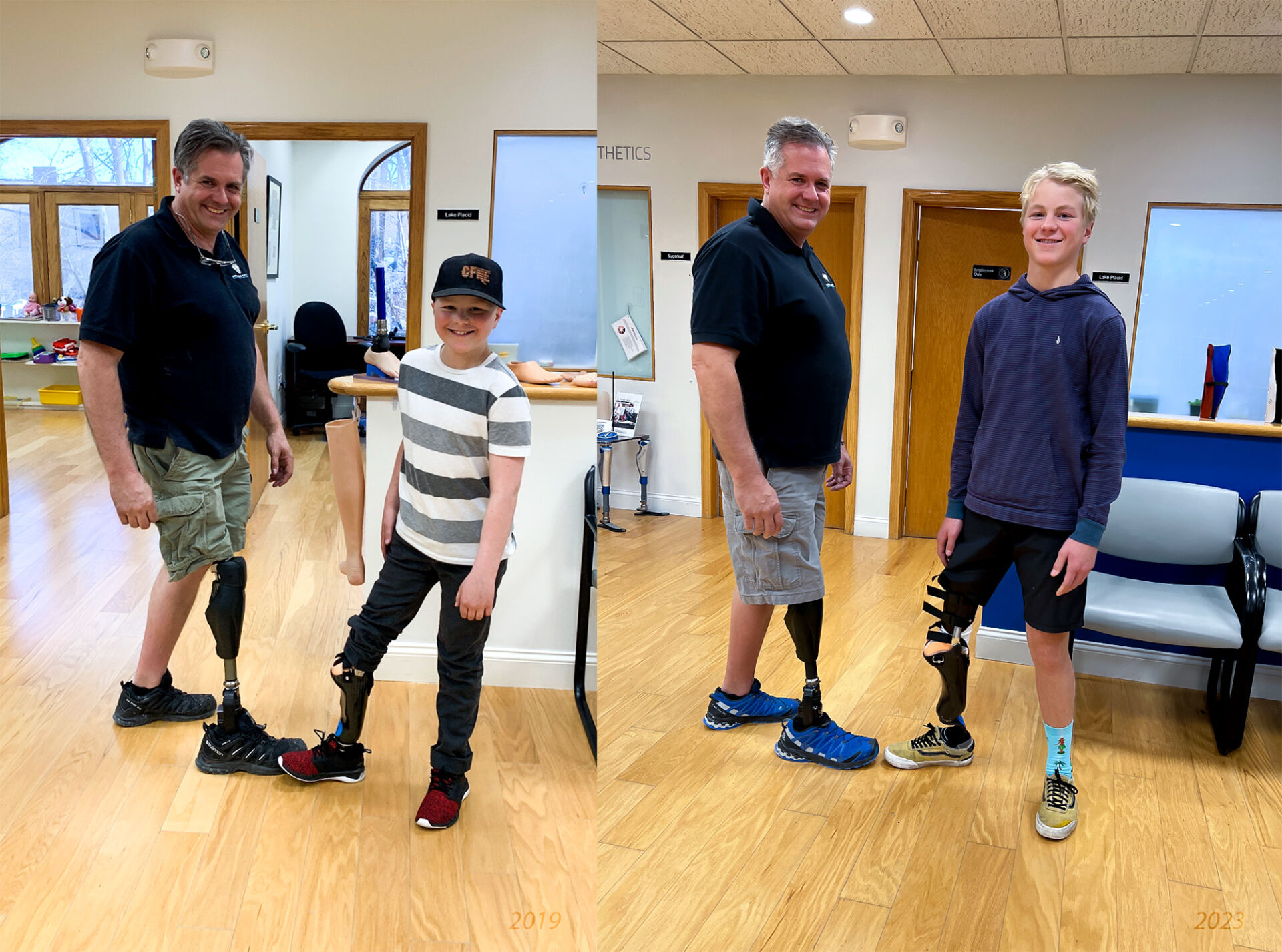 Prosthetist and patient transformation.
