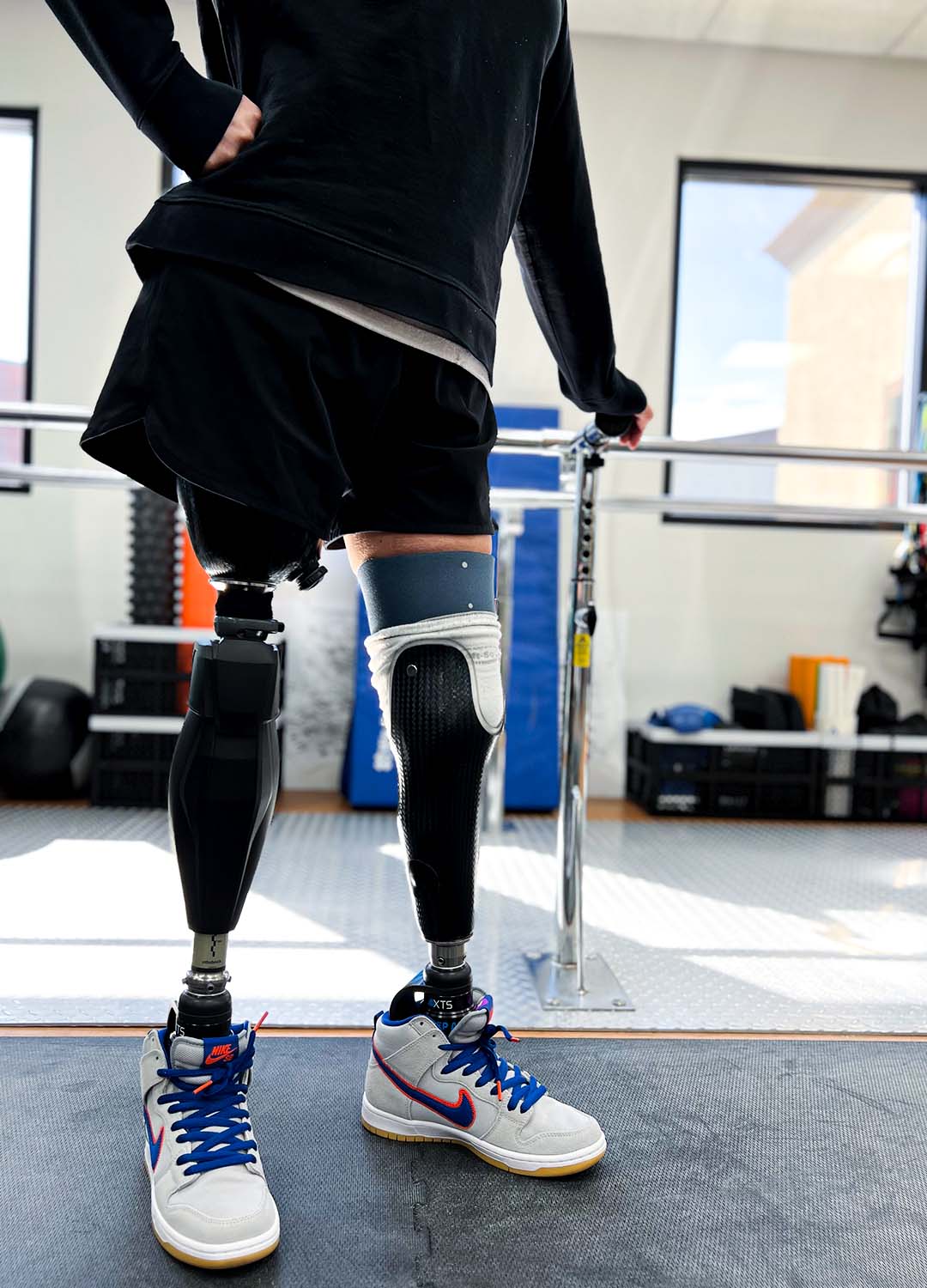 Above knee & Below Knee Amputee prosthetic training / Rehab