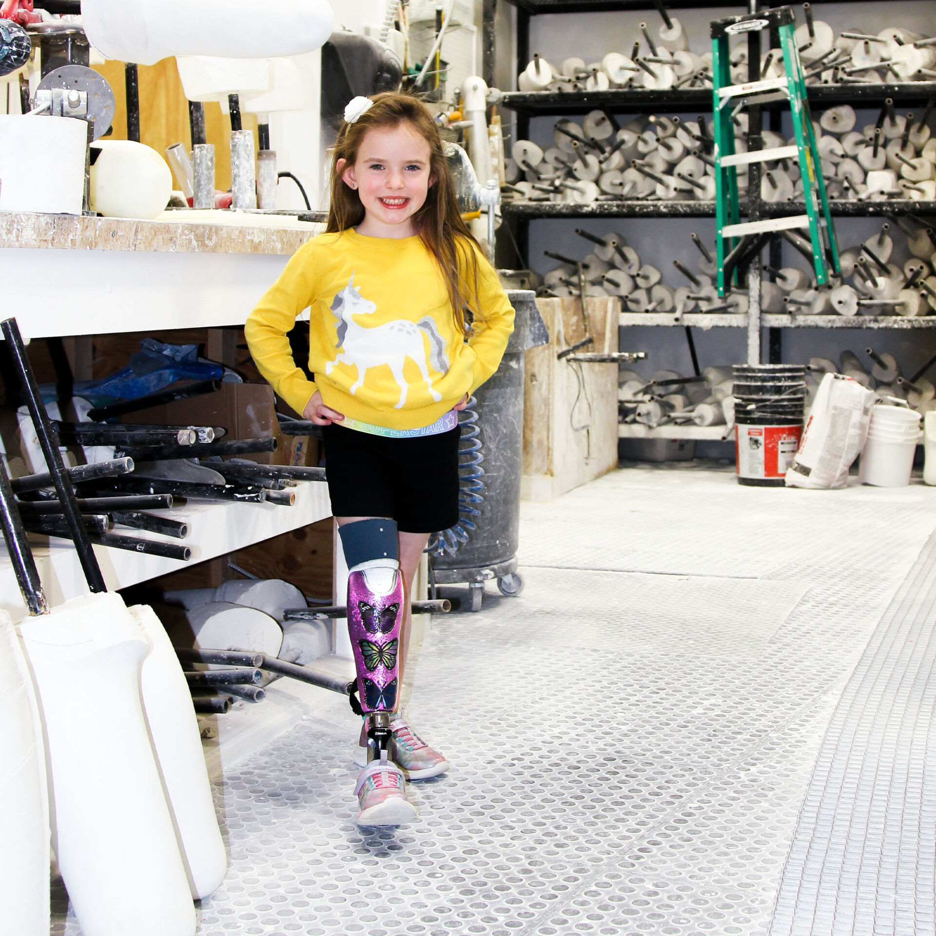 See the different type of Prosthetics & Orthotics we fabricate 