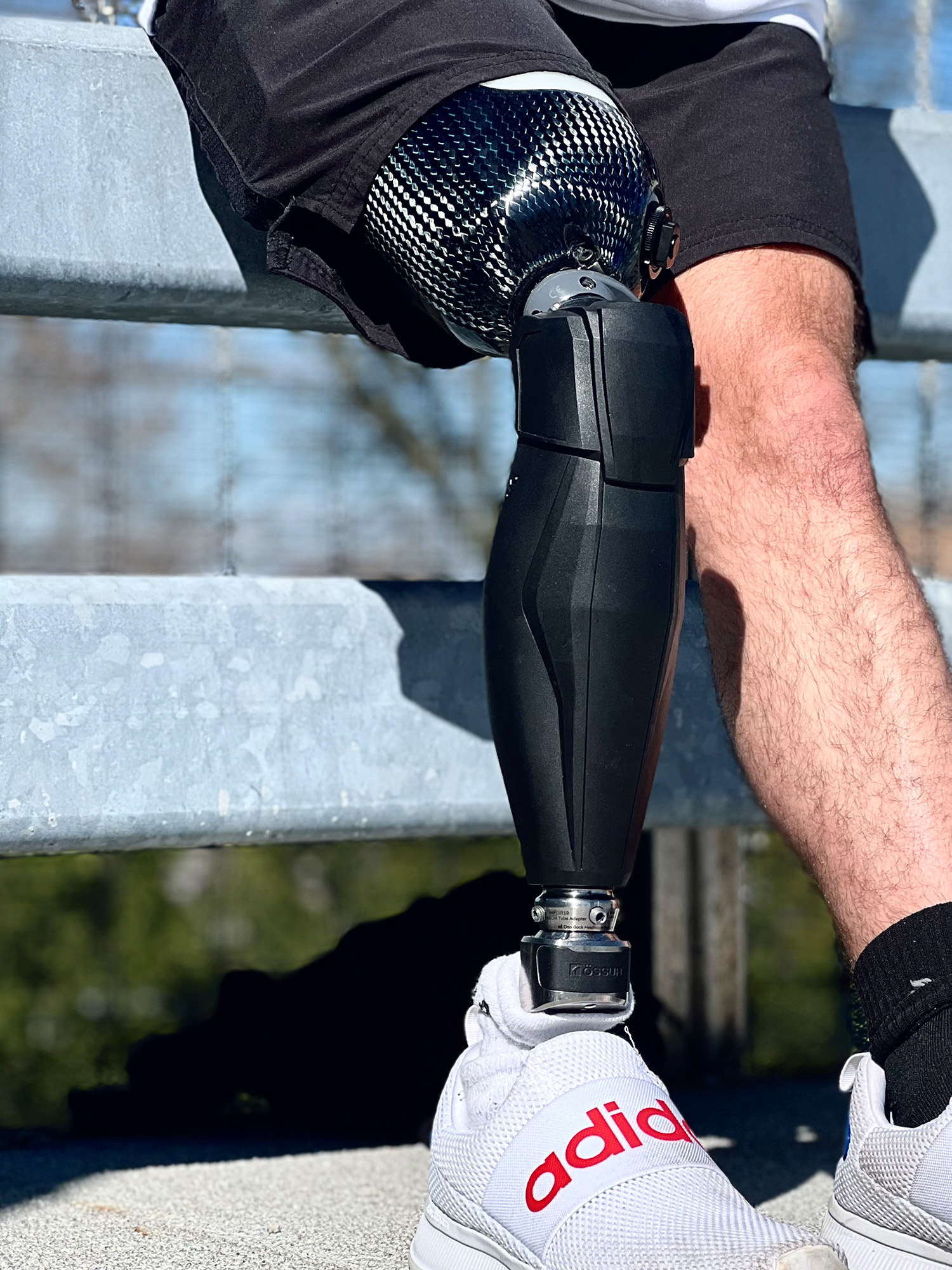 A man with a prosthetic leg wearing shoes.