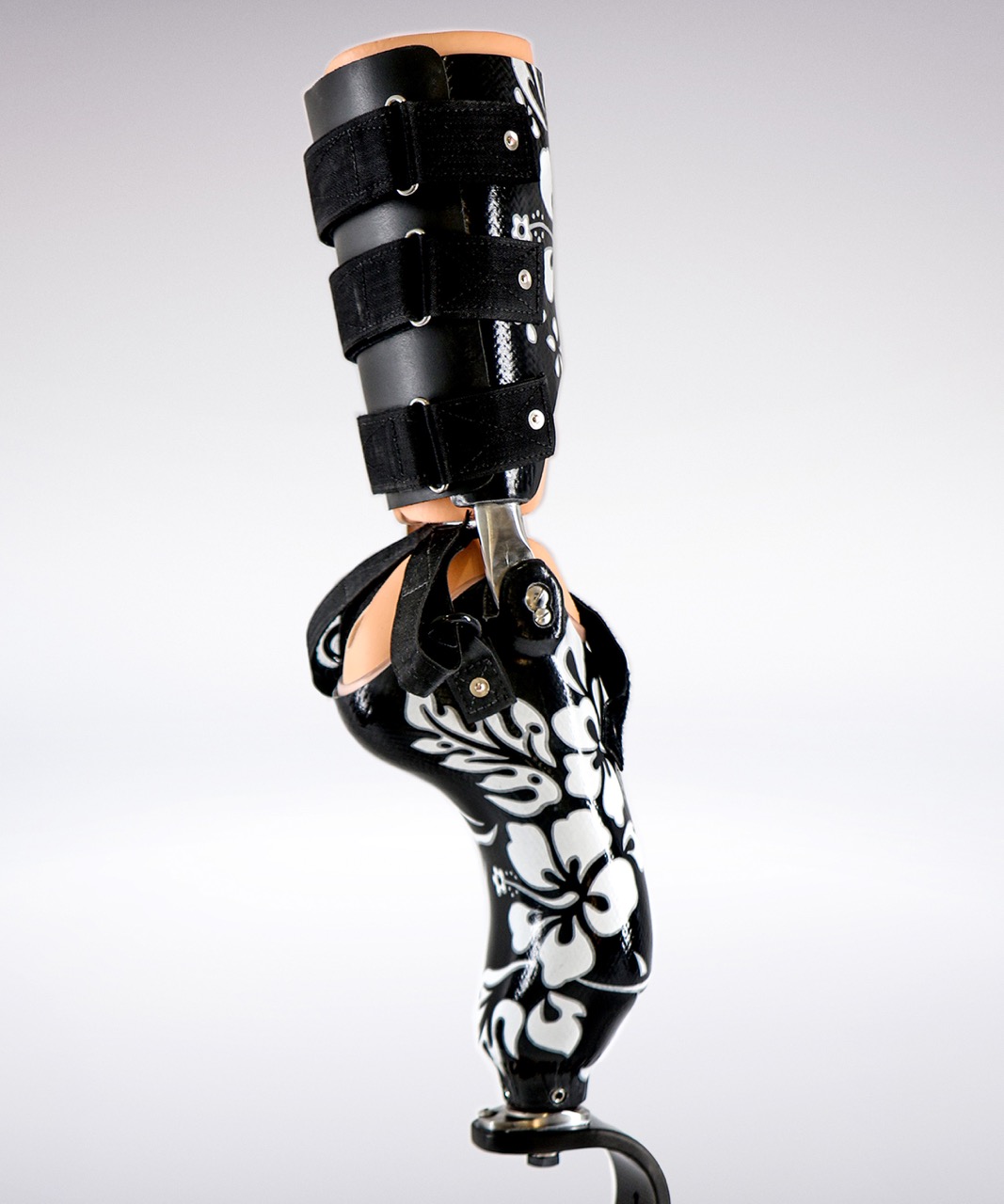 Rotationplasty prosthetic art, with flowers