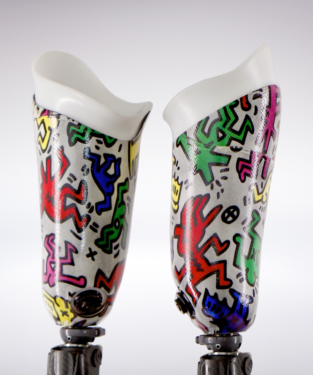 Bilateral Ak custom prosthetic sockets
