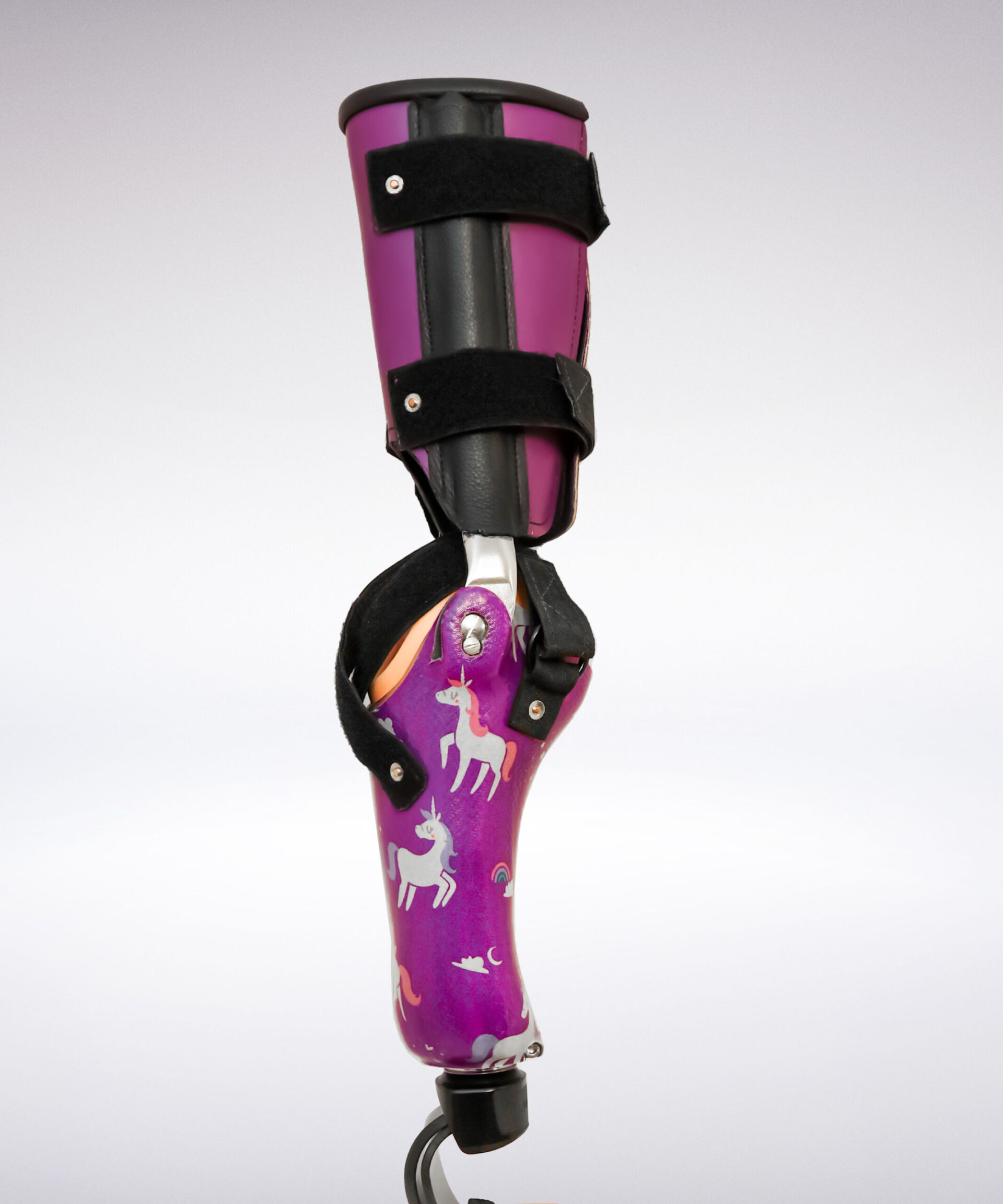 pediatric cool rotationplasty prosthetic