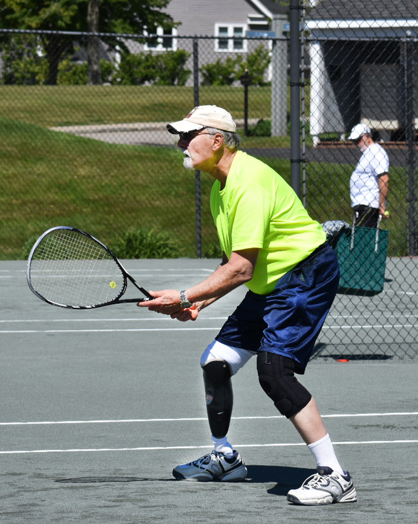 playing tennis with prosthetics