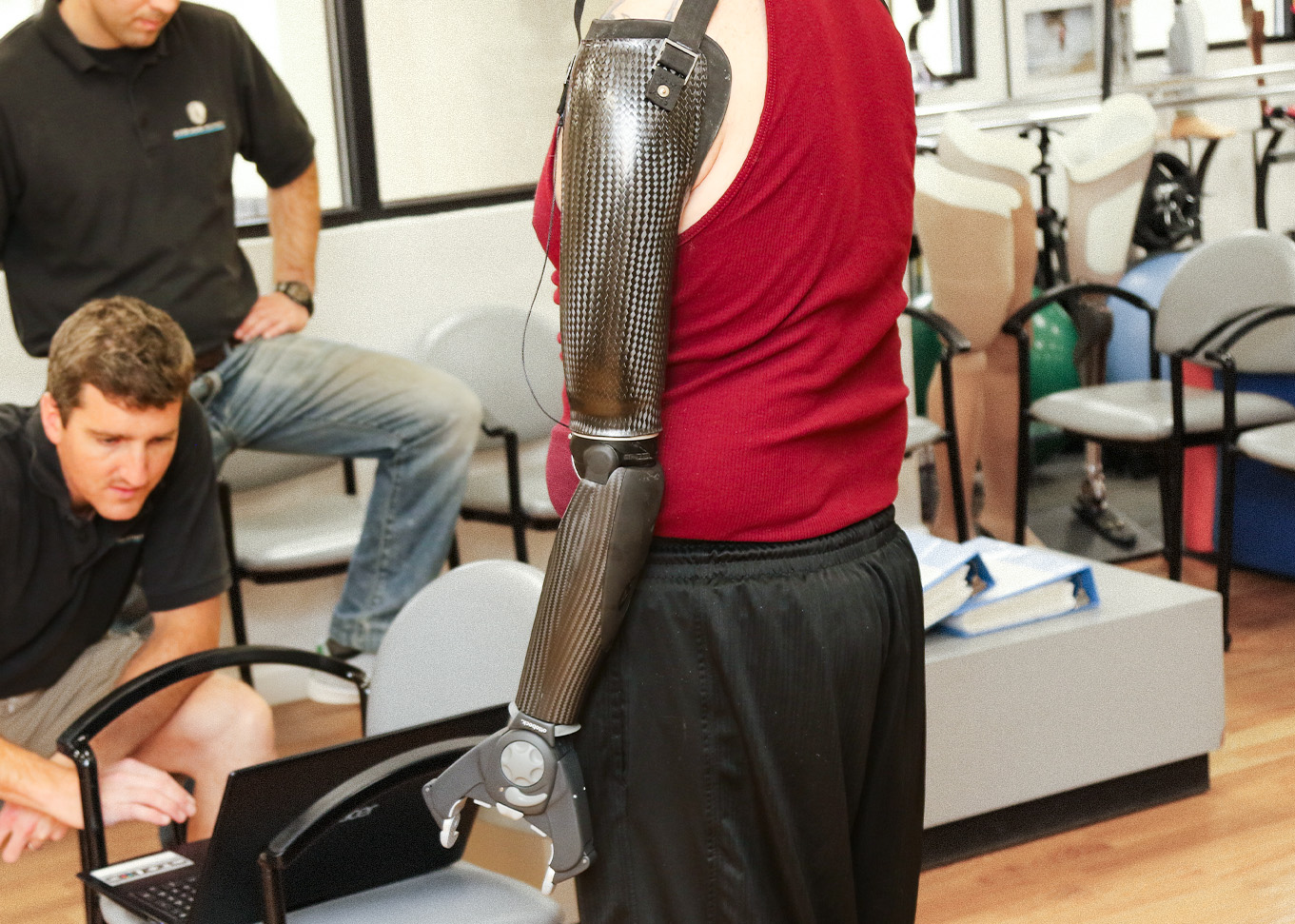 echnological Advances in Above Elbow Prosthetics