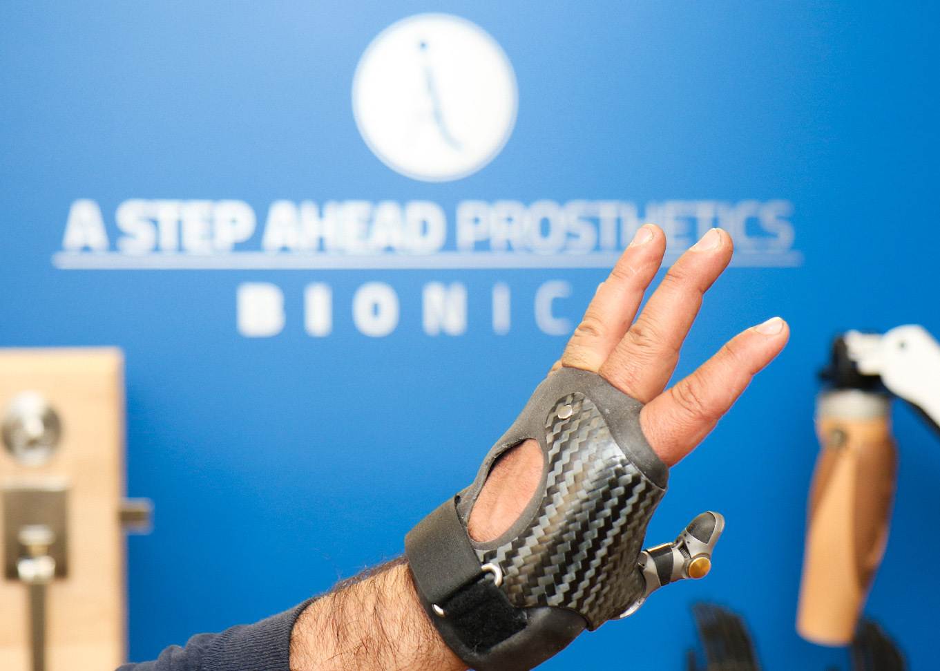Advanced Prosthetic Hand Solutions for Partial Hand Amputees
