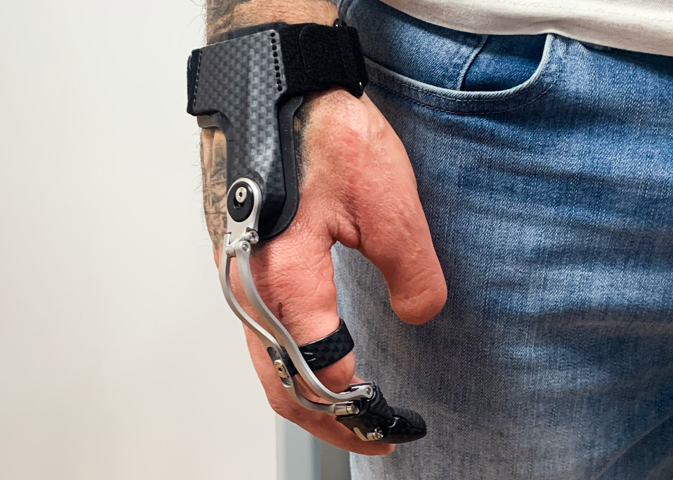 Advanced Finger Prosthetics: Enhancing Mobility for Amputees