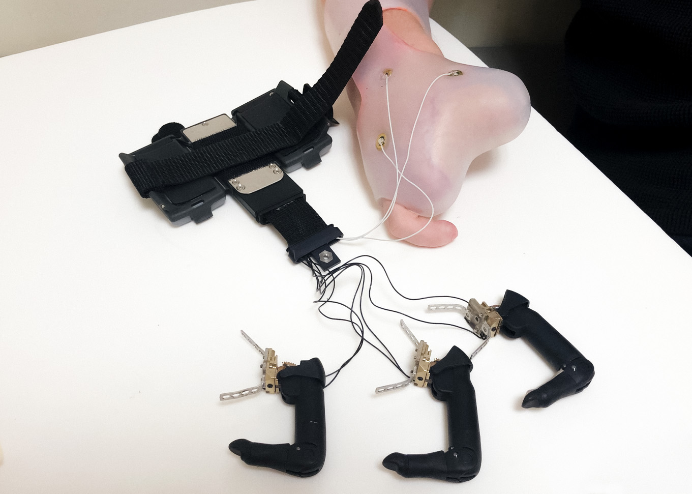 Precision and Control: Prosthetic Hand for Partial Finger and Hand Amputees