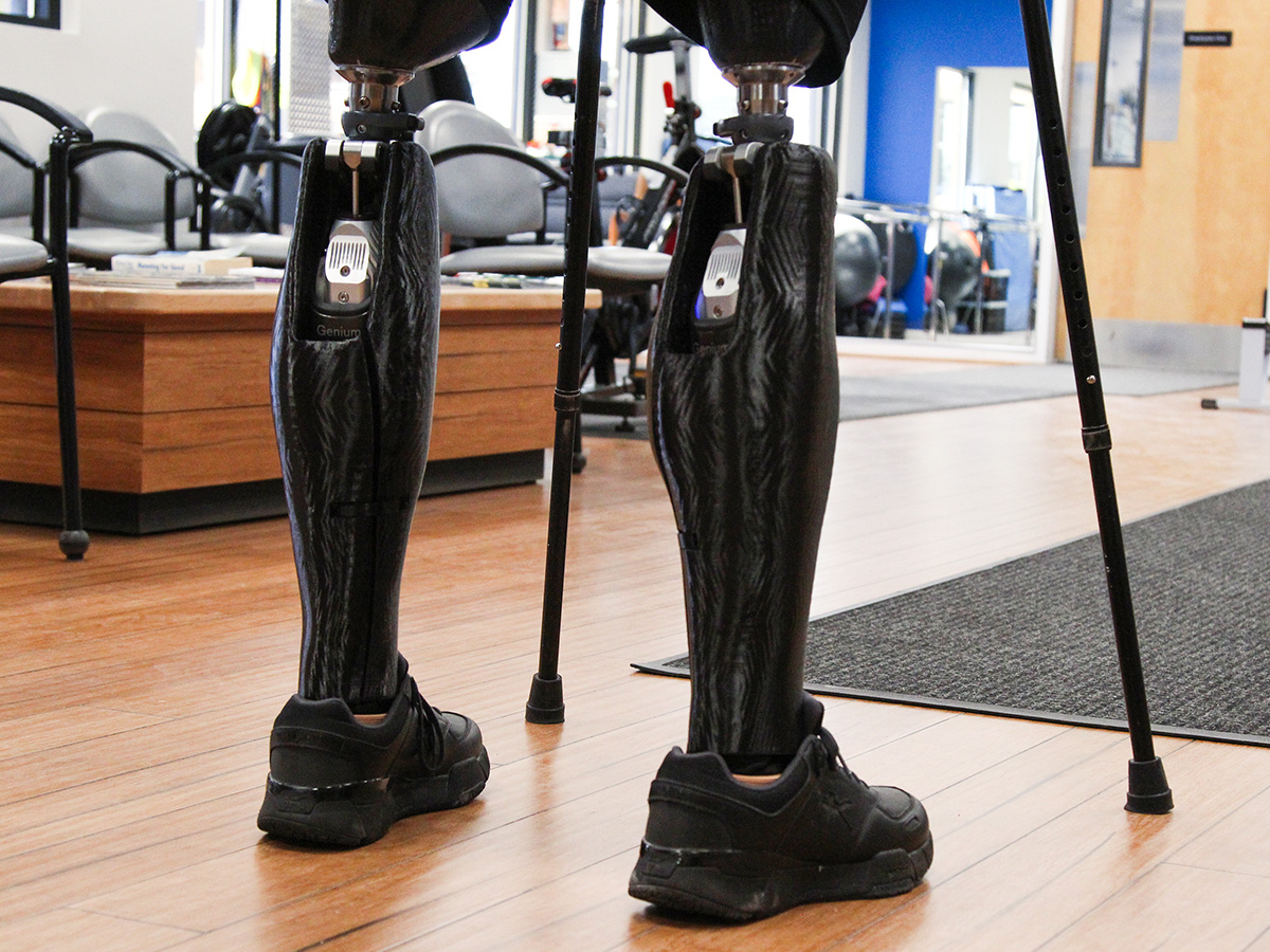 Custom-fit 3D printed prosthetic leg cover in sleek black with geometric patterns
