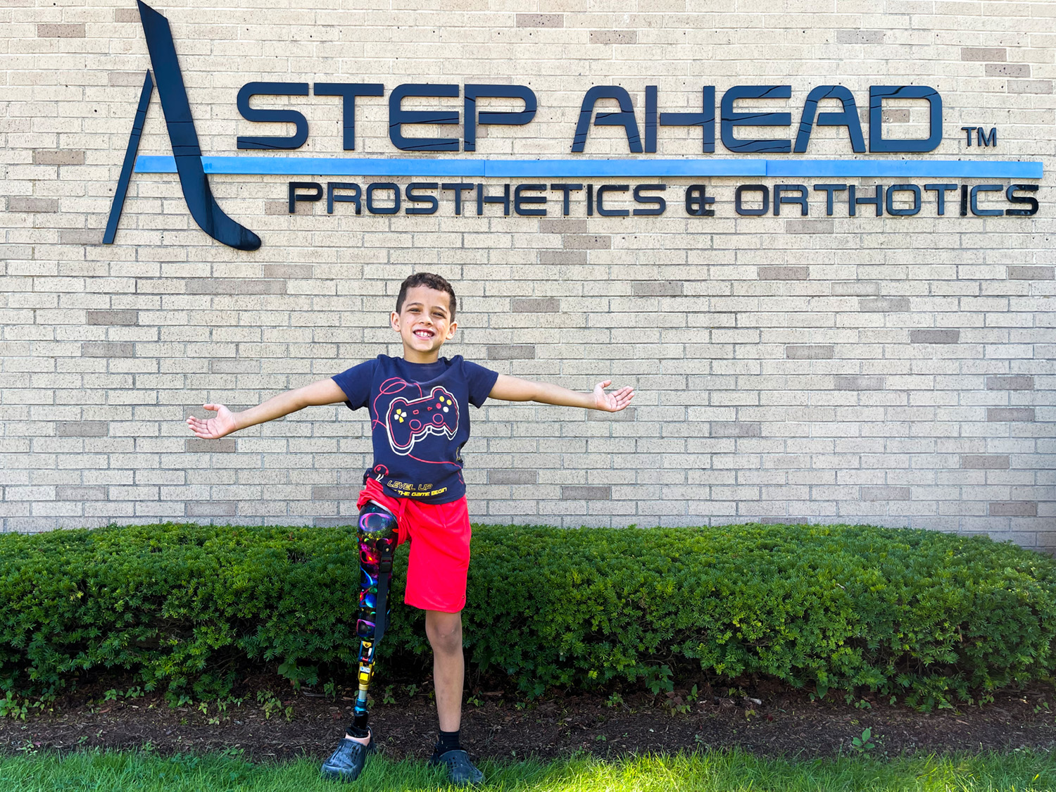 Pediatric above-knee prosthetic with growth