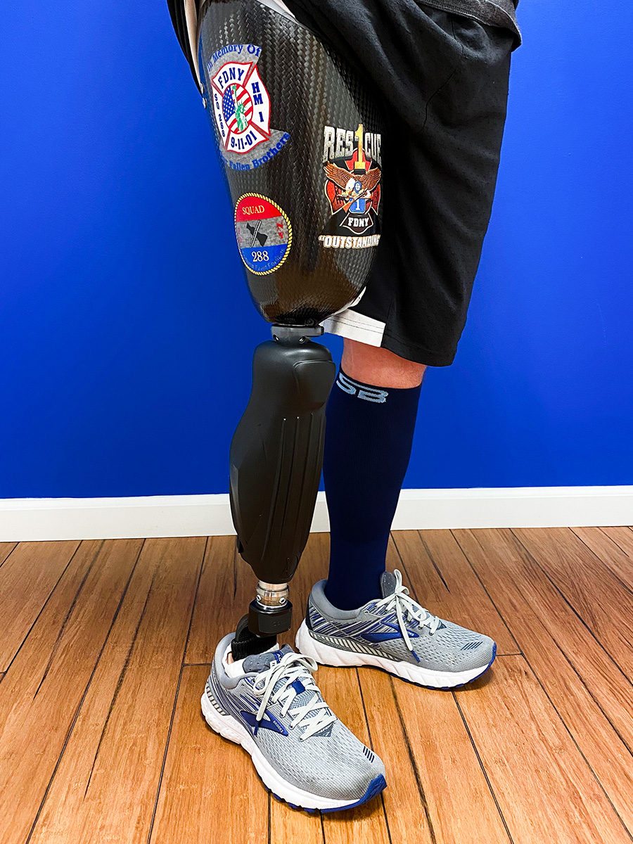Carbon fiber above-knee prosthetic leg for daily use