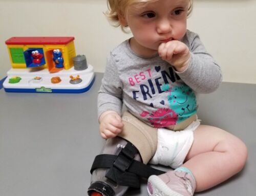 High-Activity Prosthetic Leg Donated to 7-Year-Old AK Amputee